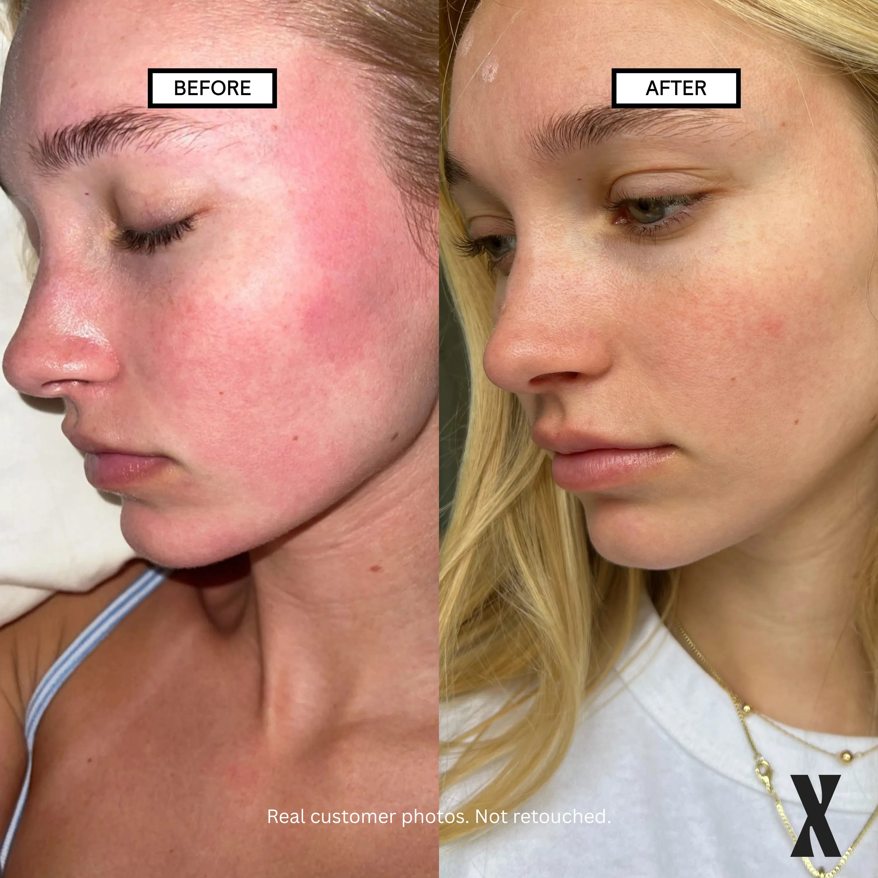 Image of Blank Slate Micellar Water