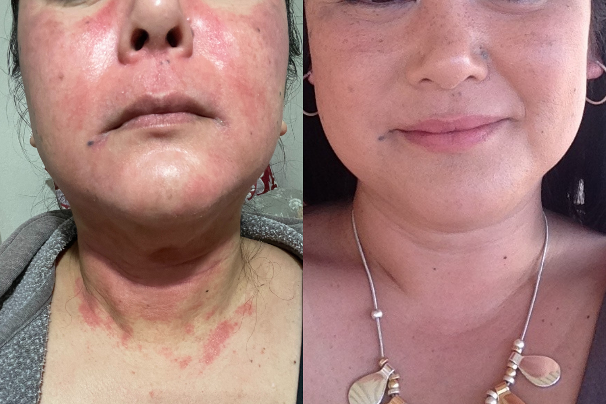 Untoxicated Skincare