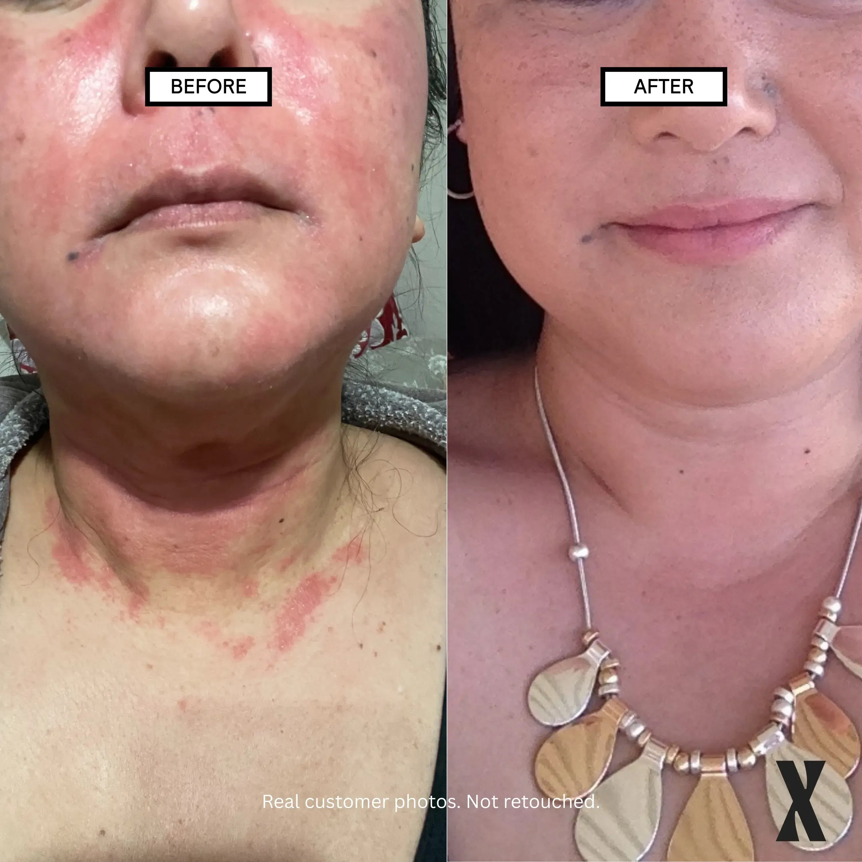 Image of Moisture Boost Face & Body Cream